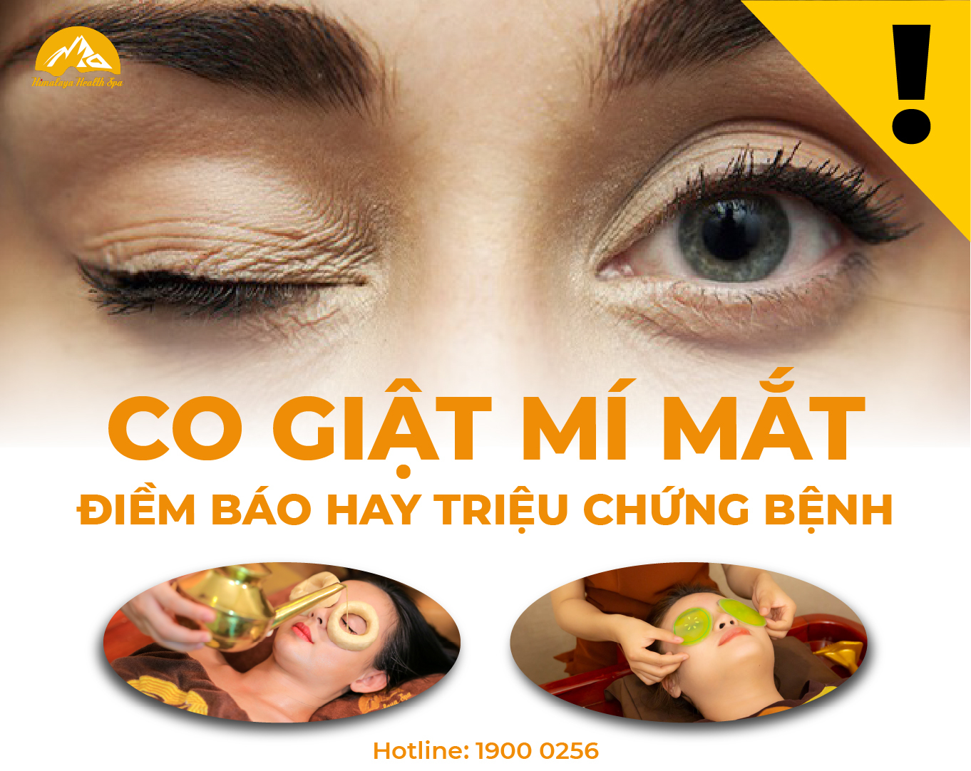 Co giật mí mắt là bị bệnh gì Himalaya Spa