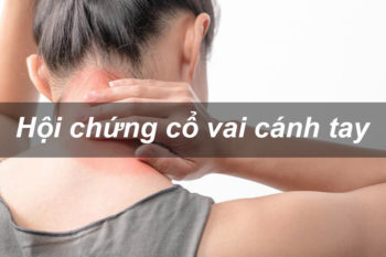 Hoi chung co vai canh tay 1