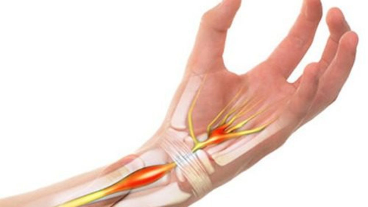 Động tác nghiêng cổ tay về phía bên có tác dụng gì trong việc chữa đau cổ tay?
