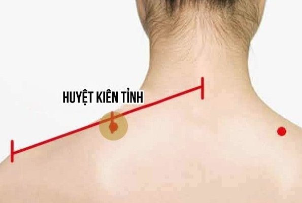 Xách định vị trí huyệt kiên tỉnh